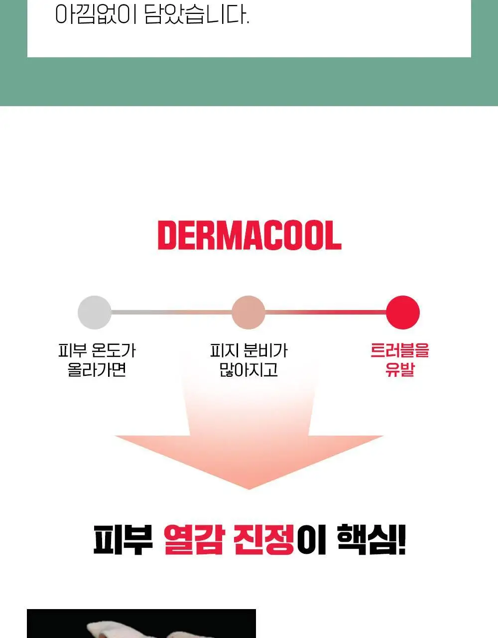 [단독기획/트러블진정] 파티온 노스카나인 트러블 세럼 마스크팩 기획(4+1) 상세페이지 6